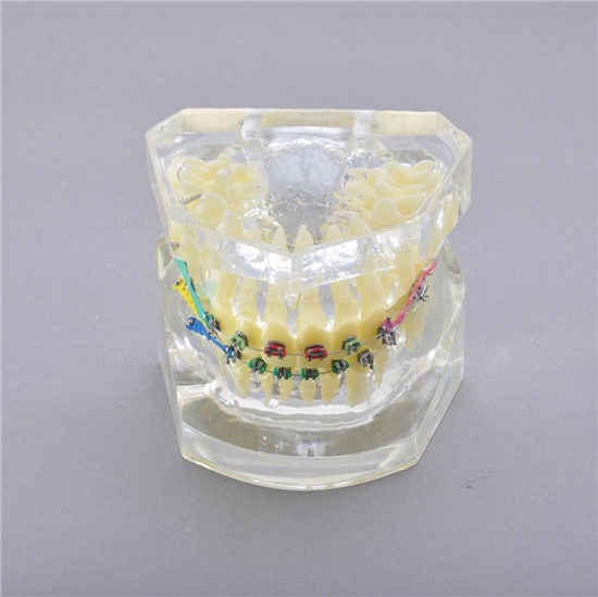 Dental Modelo M-3005 II tratamiento de solapamientos dentales